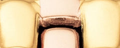 Cadie Watch, 17.5 Mm X 28.5 Mm